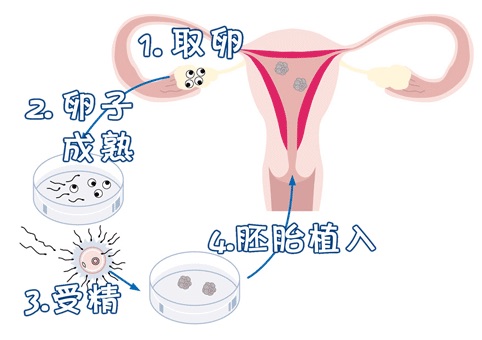 林靜遠